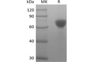 Western Blotting (WB) image for Tumor-Associated Calcium Signal Transducer 2 (TACSTD2) (Active) protein (Fc Tag) (ABIN7319895) (TACSTD2 Protein (Fc Tag))