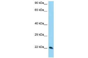 WB Suggested Anti-TSN Antibody Titration: 1. (Translin Antikörper  (Middle Region))