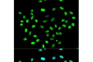 Immunofluorescence analysis of MCF-7 cells using HNRNPK Polyclonal Antibody (HNRNPK Antikörper)