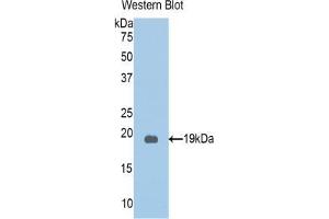 Western blot analysis of the recombinant protein. (PKN2 Antikörper  (AA 323-464))