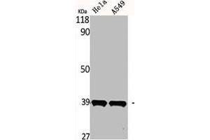 Western Blot analysis of HELA A549 cells using MEL-1B-R Polyclonal Antibody (Melatonin Receptor 1B Antikörper  (C-Term))