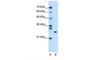 Image no. 1 for anti-RNA Binding Protein with Multiple Splicing (RBPMS) (AA 43-92) antibody (ABIN320529) (RBPMS Antikörper  (AA 43-92))
