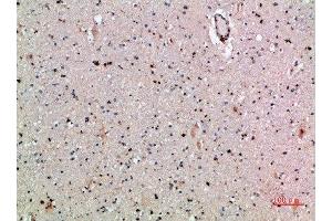 Immunohistochemical analysis of paraffin-embedded human-brain, antibody was diluted at 1:200 (CLEC4A Antikörper  (AA 161-210))