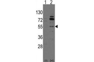 Western Blotting (WB) image for anti-Cdc42 Guanine Nucleotide Exchange Factor (GEF) 9 (Arhgef9) antibody (ABIN3001570) (Arhgef9 Antikörper)