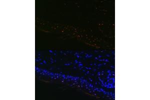 Immunofluorescence analysis of Mouse tail and ear using MITF Rabbit mAb (ABIN7268511) at dilution of 1:100 (40x lens). (MITF Antikörper)