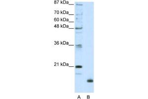 Western Blotting (WB) image for anti-Ribosomal Protein L32 (RPL32) antibody (ABIN2462057)