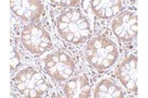 Immunohistochemistry of TEM2 in human colon tissue with this product at 2. (RASD2 Antikörper  (C-Term))