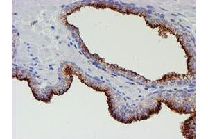 Image no. 1 for anti-Myocyte Enhancer Factor 2C (MEF2C) antibody (ABIN1499365) (MEF2C Antikörper)