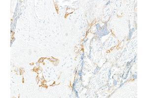 Immunohistochemistry (IHC) image for anti-Oxidized Low Density Lipoprotein (Lectin-Like) Receptor 1 (OLR1) (AA 61-273) antibody (ABIN7795657) (Rekombinanter OLR1 Antikörper  (AA 61-273))