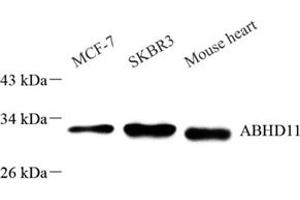 Western blot analysis of ABHD11 (ABIN7072873) at dilution of 1: 1000 (ABHD11 Antikörper)