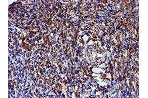 Image no. 10 for anti-Chromosome 1 Open Reading Frame 50 (C1ORF50) antibody (ABIN1497033)