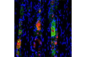 IF on rat trigeminal using Mouse monoclonal antibody to rat p75NTR (ABIN350707) at a concentration of 10 µg/ml (green), Rabbit antibody to internal part of cFos (c-fos): whole serum (ABIN350207) at 1 : 500 dilution and DAPI counterstained appearing in blue. (NGFR Antikörper)