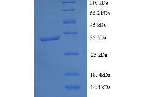 SDS-PAGE (SDS) image for Transmembrane Protein 44 (TMEM44) (partial) protein (His-SUMO Tag) (ABIN5710512) (TMEM44 Protein (partial) (His-SUMO Tag))