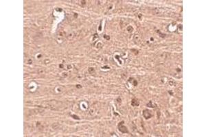 Immunohistochemistry of Gle1 in mouse brain tissue with Gle1 antibody at 2. (GLE1 Antikörper  (C-Term))