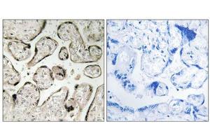 Immunohistochemistry analysis of paraffin-embedded human placenta tissue using GIMAP5 antibody. (GIMAP5 Antikörper  (C-Term))