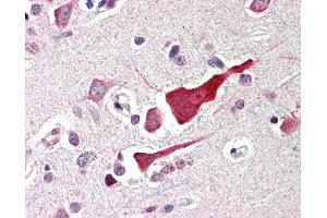 Anti-BCL2L10 / BCL-B antibody IHC of human brain, cortex. (BCL2L10 Antikörper  (N-Term))