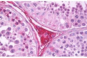 Anti-EDA2R antibody IHC staining of human testis, Leydig cells. (Ectodysplasin A2 Receptor Antikörper)
