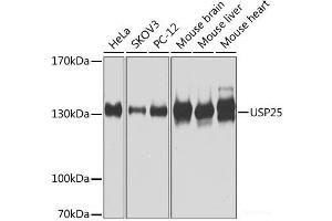Western blot analysis of extracts of various cell lines using USP25 Polyclonal Antibody at dilution of 1:1000. (USP25 Antikörper)