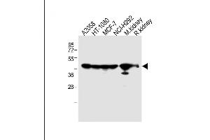 All lanes : Anti-P14 Antibody (N-term) at 1:2000 dilution Lane 1:  whole cell lysate Lane 2: HT-1080 whole cell lysate Lane 3: MCF-7 whole cell lysate Lane 4: NCI- whole cell lysate Lane 5: Mouse kidney lysate Lane 5: Rat kidney lysate Lysates/proteins at 20 μg per lane. (MMP14 Antikörper  (N-Term))