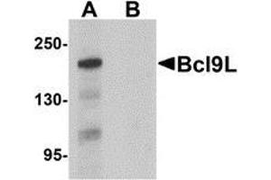 Western blot analysis of Bcl9L in HeLa cell lysate with Bcl9L antibody at 1 μg/ml in (A) the absence and (B) the presence of blocking peptide. (BCL9L Antikörper  (N-Term))