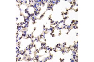 Immunohistochemistry of paraffin-embedded Mouse lung using C1R antibody at dilution of 1:100 (x400 lens). (C1R Antikörper)