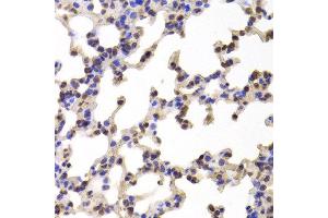 Immunohistochemistry of paraffin-embedded Mouse lung using C1R antibody at dilution of 1:100 (x400 lens).