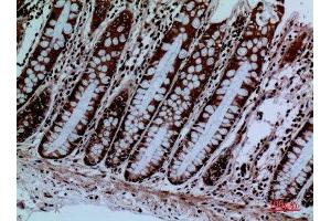 Immunohistochemistry (IHC) analysis of paraffin-embedded Human Colon, antibody was diluted at 1:100.