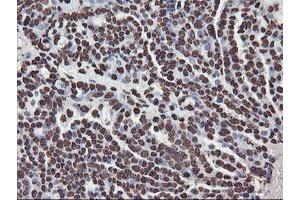 Image no. 12 for anti-F-Box Protein 21 (FBXO21) antibody (ABIN1498233) (FBXO21 Antikörper)