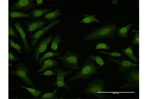 Immunofluorescence of purified MaxPab antibody to TPRKB on HeLa cell. (TPRKB Antikörper  (AA 1-175))
