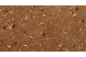 Immunohistochemistry of paraffin-embedded Human brain tissue using MAGEB18 Polyclonal Antibody at dilution 1:30 (MAGEB18 Antikörper)