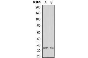 Western blot analysis of Syntaxin 1A expression in A431 (A), K562 (B) whole cell lysates. (STX1A Antikörper)