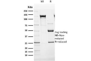SDS-PAGE Analysis Purified Cytokeratin 14 Monoclonal Antibody (SPM263). (KRT14 Antikörper  (C-Term))
