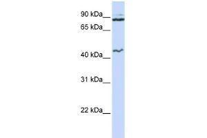 WB Suggested Anti-MCM9 Antibody Titration:  0. (MCM9 Antikörper  (N-Term))