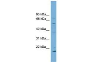 Image no. 1 for anti-Cytochrome P450, Family 2, Subfamily R, Polypeptide 1 (CYP2R1) (AA 179-228) antibody (ABIN6746310) (CYP2R1 Antikörper  (AA 179-228))