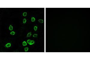 Peptide - +Immunohistochemistry analysis of paraffin-embedded human pancreas tissue using ATP5G3 antibody. (ATP5G3 Antikörper)