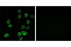 Peptide - +Immunohistochemistry analysis of paraffin-embedded human pancreas tissue using ATP5G3 antibody.