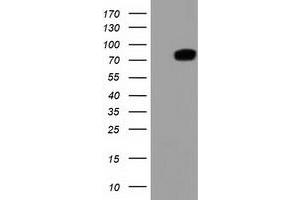 Western Blotting (WB) image for anti-Thimet Oligopeptidase 1 (THOP1) antibody (ABIN1501380)