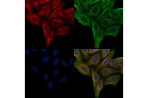 ABIN6257215 and ABIN6276011 staining Hela cells by IF/ICC.
