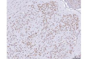 IHC analysis of PRKRA using anti-PRKRA antibody (ABIN7600141).