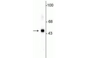 Western blot of HeLa lysate showing specific immunolabeling of the ~49 kDa SAP49 protein. (SF3B4 Antikörper)