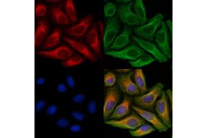 ABIN6263950 and ABIN6272733 staining Hela cells by IF/ICC. (P2RY2 Antikörper  (C-Term))
