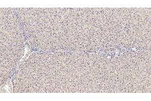 Detection of SERPINB4 in Human Liver Tissue using Monoclonal Antibody to Serpin Peptidase Inhibitor,Clade B,Member 4 (SERPINB4) (SERPINB4 Antikörper  (AA 144-298))