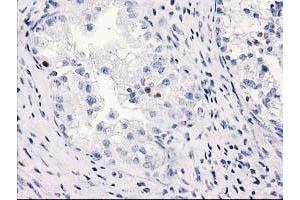 Immunohistochemistry (IHC) image for anti-Chromosome 1 Open Reading Frame 50 (C1ORF50) antibody (ABIN1497032) (C1ORF50 Antikörper)
