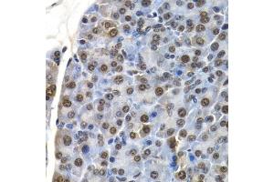 Immunohistochemistry of paraffin-embedded mouse pancreas using ID3 antibody (ABIN6130481, ABIN6142140, ABIN6142141 and ABIN6221020) at dilution of 1:200 (40x lens). (ID3 Antikörper  (AA 1-119))