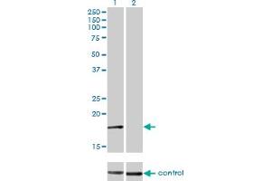 Western blot analysis of AP2S1 over-expressed 293 cell line, cotransfected with AP2S1 Validated Chimera RNAi (Lane 2) or non-transfected control (Lane 1). (AP2S1 Antikörper  (AA 1-142))