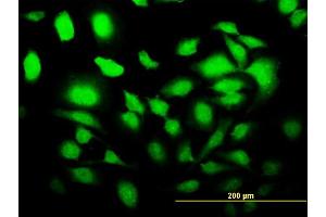 Immunofluorescence of monoclonal antibody to SLC2A4RG on HeLa cell. (SLC2A4RG Antikörper  (AA 178-269))