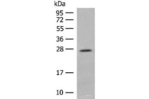 Western blot analysis of Human placenta tissue lysate using MDFI Polyclonal Antibody at dilution of 1:400 (MDFI Antikörper)
