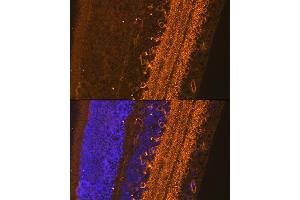 Immunofluorescence analysis of Rat eyeball using G/G/G antibody (ABIN3017018, ABIN3017019, ABIN3017020 and ABIN6219924) at dilution of 1:100. (GAD Antikörper  (AA 1-200))