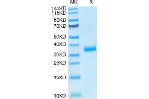SARS-COV-2 Spike RBD (N501Y) on Tris-Bis PAGE under reduced condition. (SARS-CoV-2 Spike Protein (N501Y, RBD) (His tag))