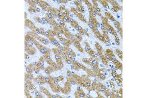 Immunohistochemistry of paraffin-embedded human liver injury using CPM antibody at dilution of 1:100 (x40 lens). (CPM Antikörper)